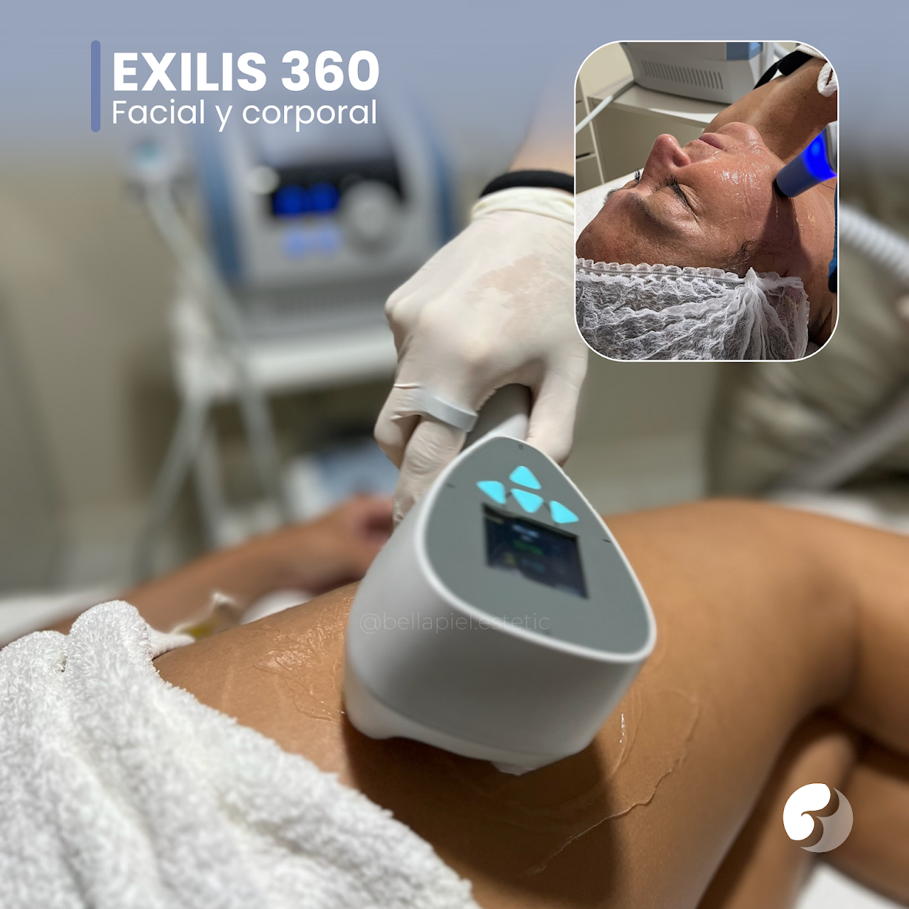 Tratamiento EXILIS 360 facial y corporal en Bella Piel