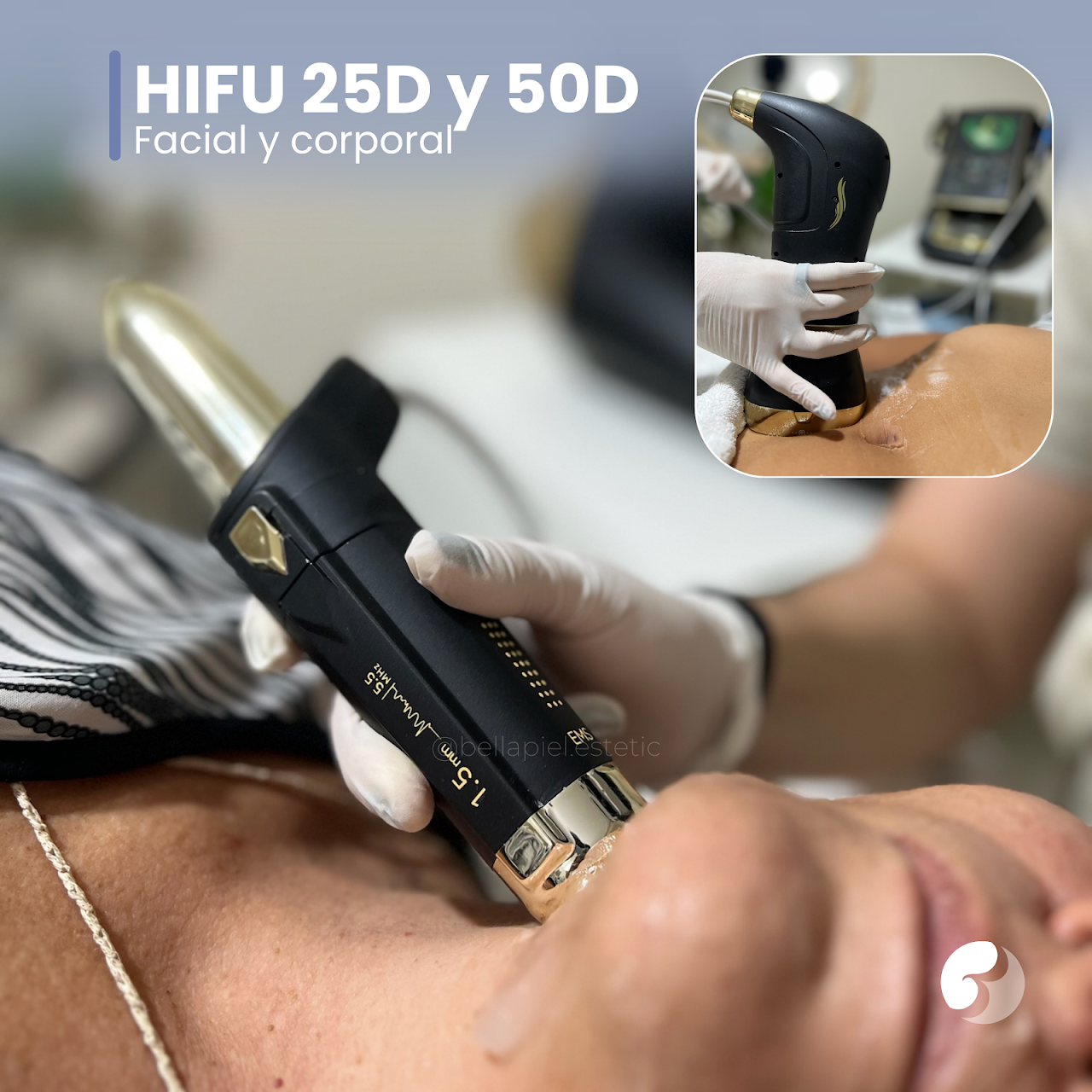 Tratamiento HIFU 25D y 50D en Bella Piel